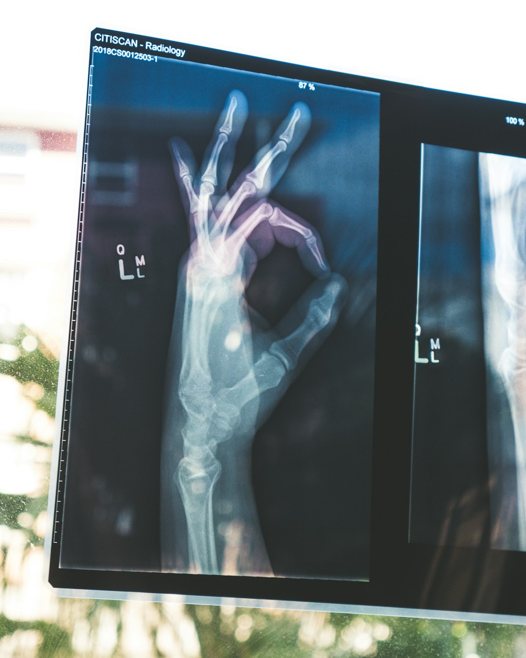 Diagnostic imaging displayed on a monitor